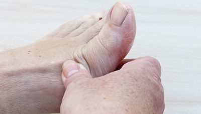 Does Your Big Toe Hurt When it Bends? It Could Be Hallux Limitus