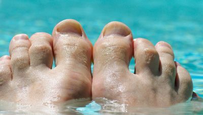 What Are Hammertoes and How Are They Treated?
