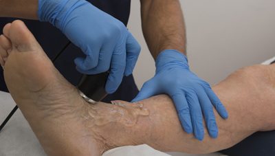 What Is MLS Laser Therapy and How Can it Help?