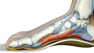 Arch Support – How to Tell if You Might Need It and What to Do