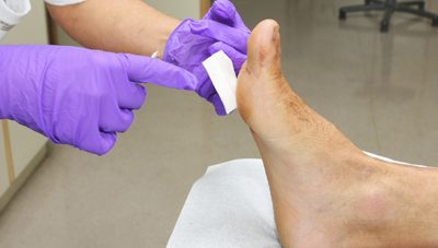 Proper Shoes For Diabetics