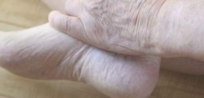 Expert Podiatrist Near Me for Seniors