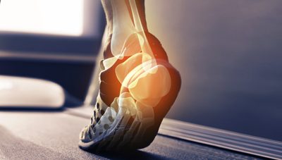 How Shockwave Therapy can Help with Chronic Heel Pain