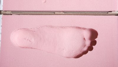 How to Know When Your Orthotics Need Replaced or Reassessed