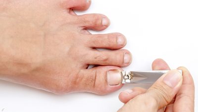 How to Stop Having Frequent Ingrown Toenails