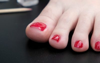 Is Never Removing Nail Polish Unhealthy for Toenails?