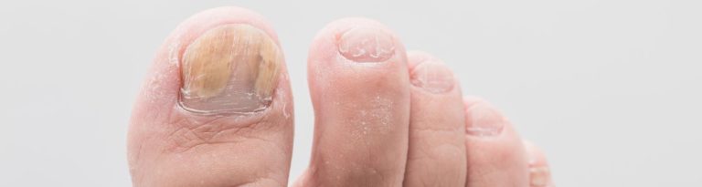 teonail e1702298668879