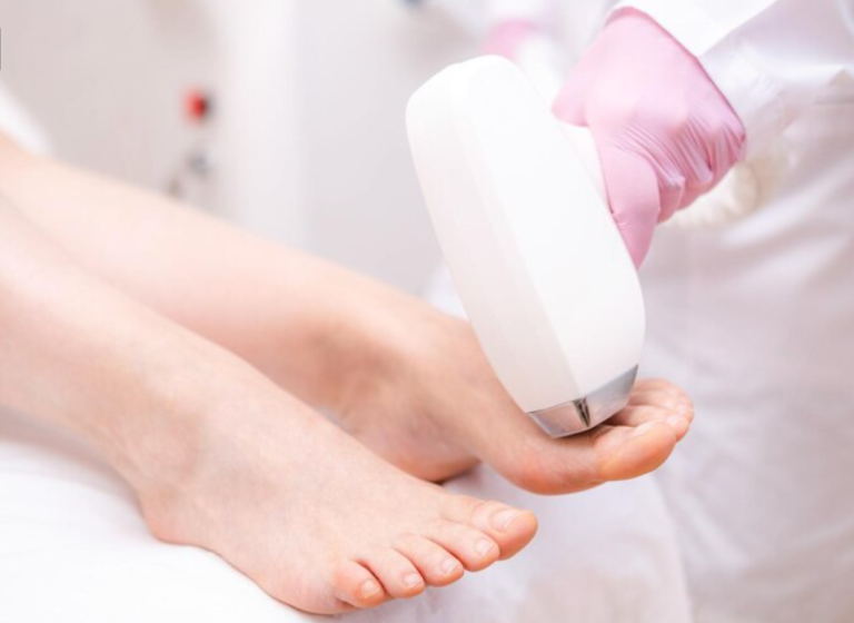 foot laser therapy