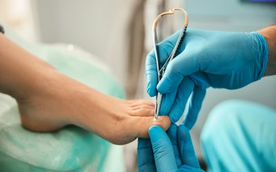 Quick Relief Methods for Ingrown Toenail Discomfort